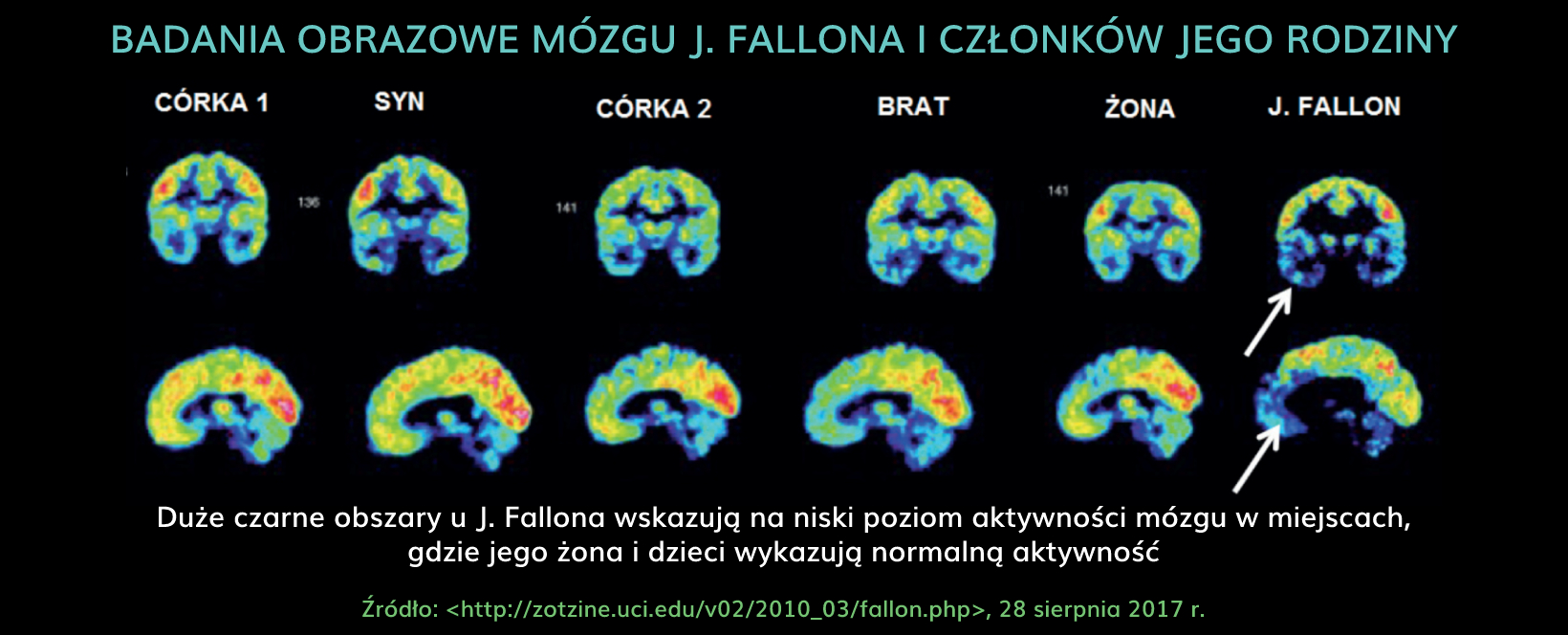 mozg_psychopaty_-_badania_obrazowe_mozgu_j.fallona.jpg