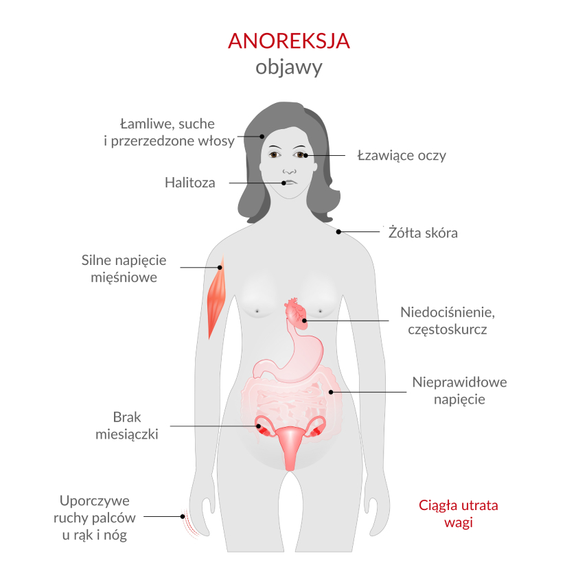 Czym S Zaburzenia Od ywiania Avigon Czym S Zaburzenia Od ywiania Avigon