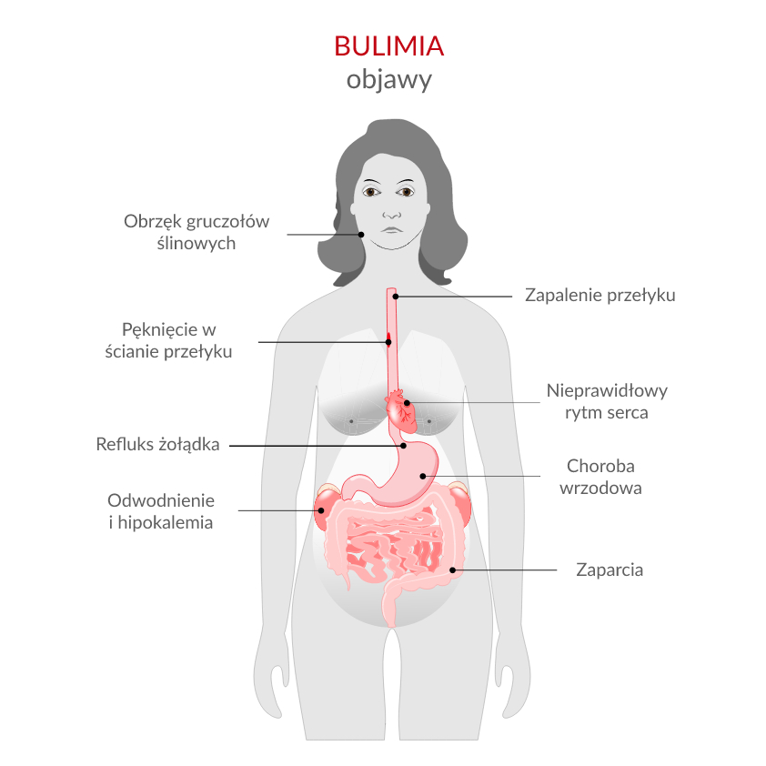 zaburzenia_odzywiania_bulimia_objawy.jpg